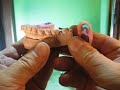 Synchronized occlusal equilibration with reduction templates