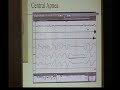 Sleep Apnea_5  Snoring Lungs and Breathing
