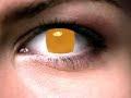 N24 Auge