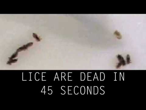 how to cure lice