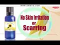 contributed by http://www.amoils.com - this video about skin tags describes a natural product which is designed to remove skin tags naturally, with no pain and side effects.

learn how to make skin tag removal easy and eliminate skin tags - cutaneous papilloma - in just a few clicks!