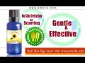 contributed by http://www.amoils.com - this video about skin tags describes a natural product which is designed to remove skin tags naturally, with no pain and side effects.

learn how to make skin tag removal easy and eliminate skin tags - cutaneous papilloma - in just a few clicks!
