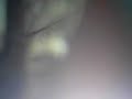 Oeil de mouche \"exorista larvarum\" microscope zoom X4