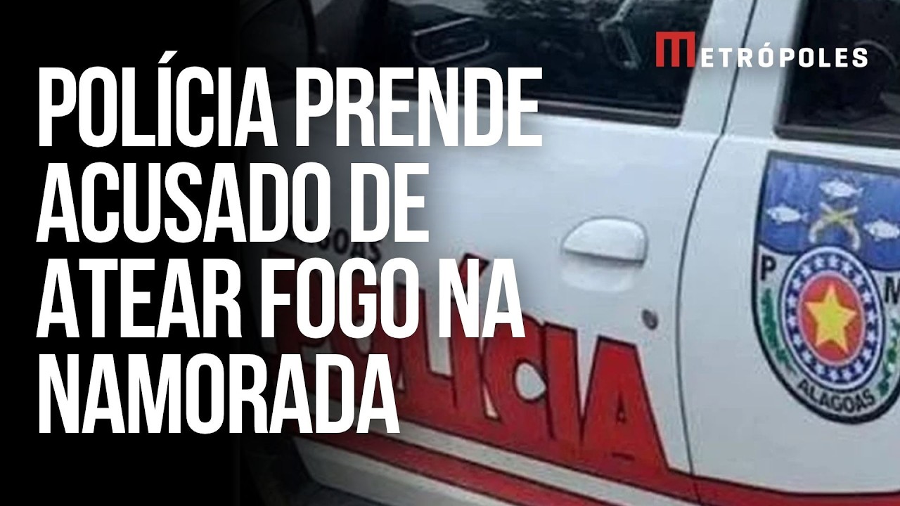 Mulher tem 90% do corpo queimado pelo namorado, que alegou ciúmes