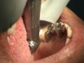 /WAMkey - Video 3