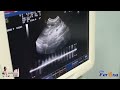 Click here to watch this video Futuros Yorkshire Terrier by Clan Ferona
