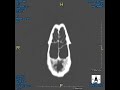 mikrogeo video 61 rac_slices2.avi
