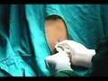 Lumbar Puncture