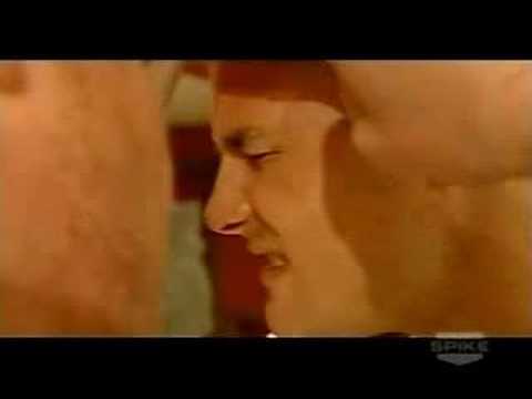 how to treat cauliflower ear