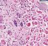 Histopathology-Tongu