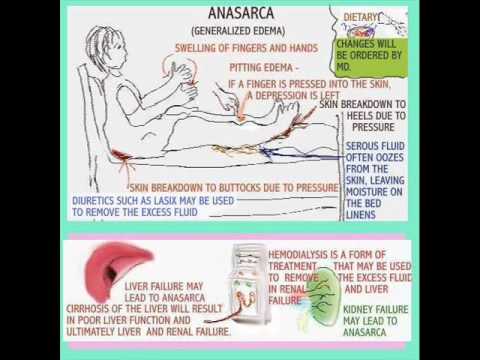 how to become an organ transplant nurse