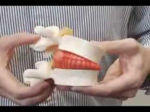 how to treat your own back