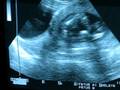 videos de 18 week sonogram