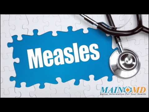 how to cure measles