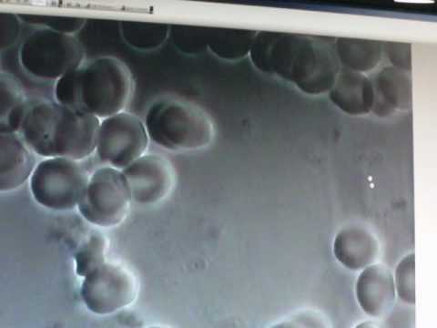 how to boost white blood cells