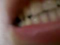 videos de Andys Classics 5