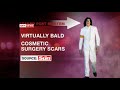 Leaked out Autopsy of Michael Jackson