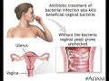 natural cure for yeast infection