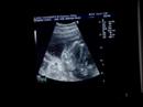 Active Baby