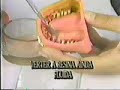 Montagem Articulador para endodontia