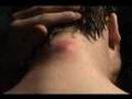 Disgusting ass lump on neck