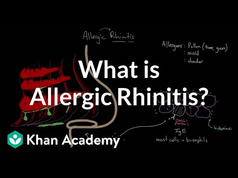 how to cure allergic rhinitis