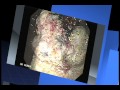 Endoscopia Gastrointestinal Presentaci
