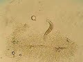 Dactylogyrus rubellus on the gill of a Sand shiner