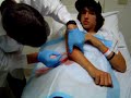tim johnson skateboard abscess tim johnson skateboard abscess