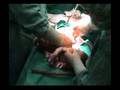 kaan yagız ikizleri Bebekler birth of twin zwilling geburt