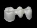 BioVista Dental Restorations CAD\\CAM Solutions