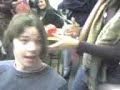 Dans hair loss part one
