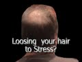 Hairclub Hairclub