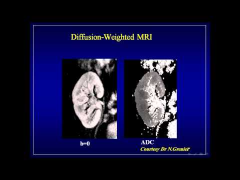 how to do a renal transplant ultrasound