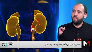 ما هي خيارات علاج حصى الكلى؟