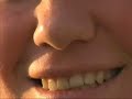 Thumbnail #3