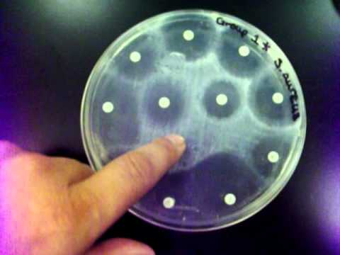 how to measure zone of inhibition bacteria