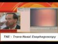 www.1800endoscope.com TNE Trans-Nasal Esophagoscope Endoscopy Endoscope Procedure on GMA Esophageal Cancer Warning Signs A simple test can detect susceptibility for the cancer. Columbia Presbyterian NY MD. IF ANYONE KNOWS THE MAKE MODEL OF THIS ENDOSCOPE SYSTEM PLEASE CONTACT US! info At 1800endoscope.com