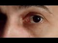Thumbnail #3