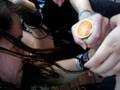 videos de estrazione del calippo