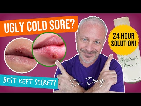 how to treat a cold sore with l-lysine