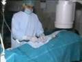 IVC Filter Deployment LIVE