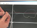 catheter