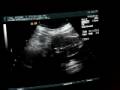 Baby Peanut-sita - 20 weeks - 1/23/09