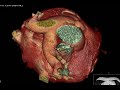 64 Slice CT Scan
