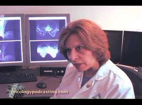 MRI and Breast Cancer