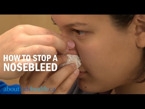 how to stop a child's nosebleed