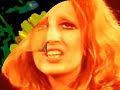 Thumbnail #1