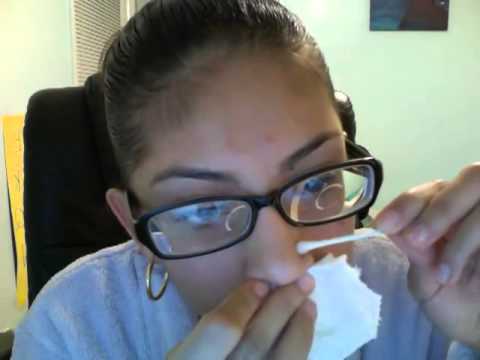 how to treat keloids