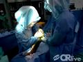 Computer-Assisted Total Knee Replacement